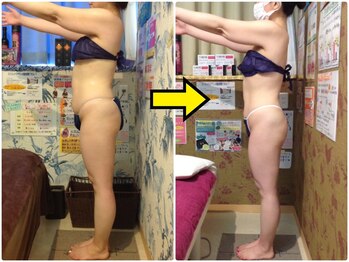 美容エステサロン ヴィアージュ 王子店(Viage)/人生初めてのダイエット成功!
