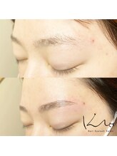 クレー(Klee)/アイブロウリフト