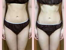 ヨサパーク ひだまり 日立店(YOSAPARK)/ルルオンでのもの凄い効果！