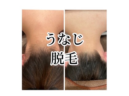 メルシートータルビューティー(MERCI)の写真