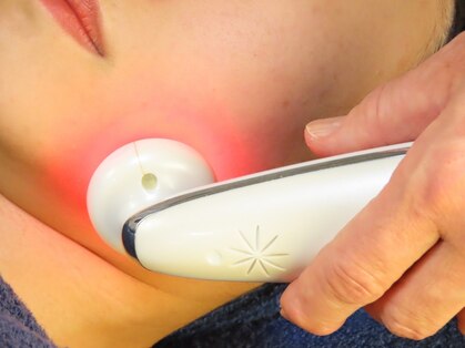 フィール(feel)の写真