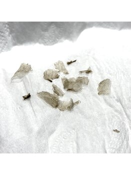 アンフェム(Anfem)/ローマピンク☆皮むけ