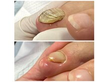 ネイルサロンアンドスクール ペルシャ(Persia)の雰囲気(伸び悩むお爪にも対応いたします♪)