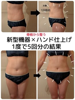 ビューティーサロン ラ ルーチェ(beauty salon La Luce)/多機能キャビテーションで結果出