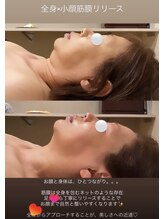 トトノエル(TOTONOEL)/全身＋小顔筋膜リリース