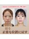 真美(Sinbi)の写真/他店で効果を感じられなかった方必見!写真でわかる圧倒的変化◎半年後の無料メンテナンス&セルフケア付