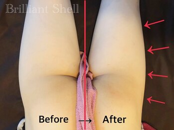 ブリリアント シェル(Brilliant Shell)/最先端!ウルトラ4Dスリム☆痩身