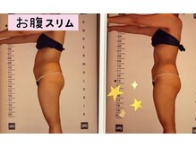 ビューティースパ/エンダモロジーアライアンス+EMS