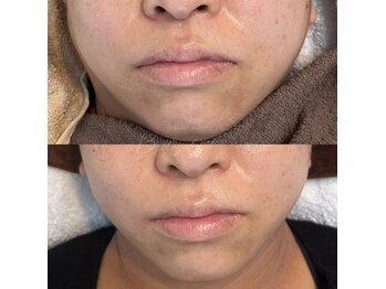 ベルアイラッシュ(Belleyelash)/【フェイシャルワックス】