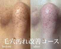 モカビューティー(MOCA BEAUTY)