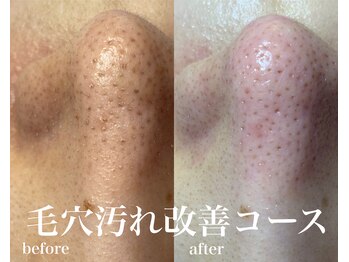 モカビューティー(MOCA BEAUTY)