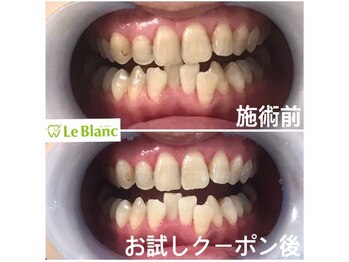 ルブラン 奈良店(Le Blanc)/沢山のメリット!