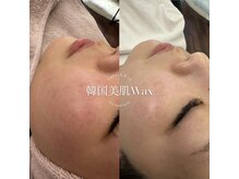 ドゥ(DOUX)の雰囲気（韓国美肌Wax 産毛・角質・くすみなど肌質改善もできます♪）