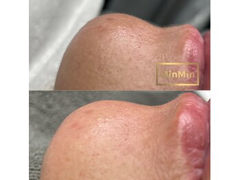 リア プラスマウナ(Li'a +MAUNA)/パーツWax 顎周り