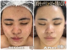 アルページュ(Arpege)の雰囲気（Arpegeの肌管理ニキビケア#シミケアが好評^_^肌土台から変化へ♪）