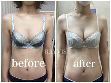 レイビス 郡山店(RAYVIS)/予約殺到★ふわふわ3Dバスト1