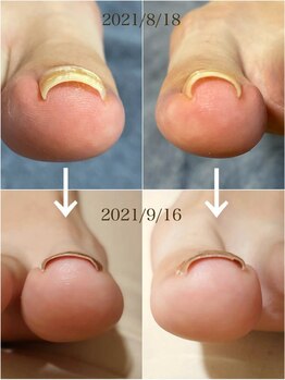 カイル 恵比寿(Kaile.)/巻いた爪ケア