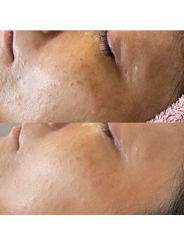 ヴィーナス(Venus)/白玉スキン