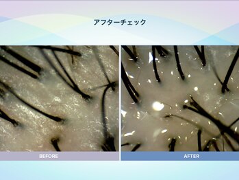 アンス(anth:)/お客様の仕上がり