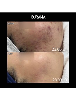 モアナ(Moana)/【ビフォーアフター】