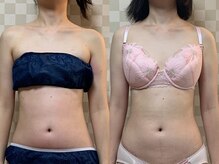 ハレオラ(HaleOla)/体重が増えてもスタイルアップ♪