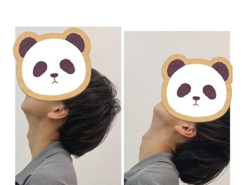 おにぎり(ONIGIRI)/★頭痛にも！首の動きも改善！★