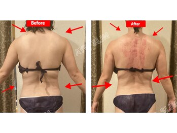 アユスリム(AYU SLIM)/一回でも変化できるの充実痩身!