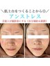 【内側から潤う】乾燥・敏感肌も水分たっぷり潤う～アンストレス～