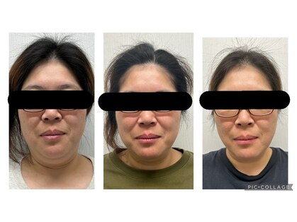 ジェミー(Gemmy)の写真