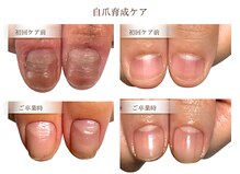 リケアネイル(Re:care nail)