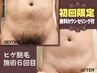 【初回限定/メンズ脱毛】メンズVIO脱毛◆福岡薬院 デリケートゾーン ¥6,980→