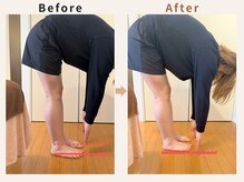 ハリデイズ/30代-腰痛、背中のハリ