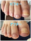 爪切り美爪ケア