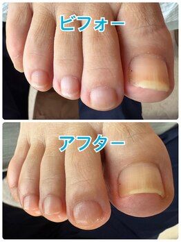 ドクターネイル爪革命 長崎佐世保店/爪切り美爪ケア