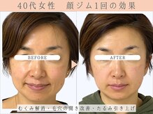 那賀洋子式 顔ジム 大分戸次店/40代女性顔ジム1回の効果