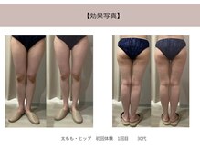 ミライ 福岡春日店(mirai)/下半身フルコース体験