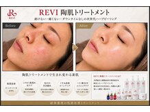ゾーンビューティーハウス 松戸店(ZONE BEAUTY HOUSE)の雰囲気（reviは肌質改善の為に開発されたハーブピーリングです！）