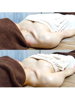 コモド(COMODO)/バストアップbefore&after