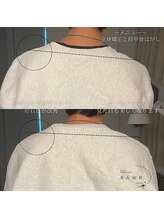 ロアー 赤坂店(RAWR)/全身矯正で左右差改善！