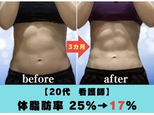 ブルーローズ(BLUE ROSE)/理想のお腹も！[柏/痩身]