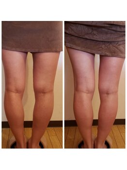 ロージーハピネス(Rosy happiness)/全身美容整体