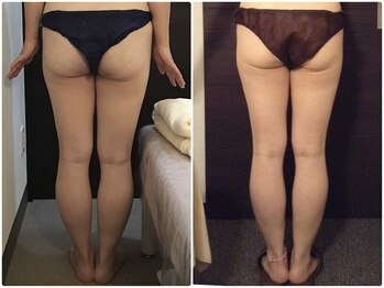 美容整体ウェリナ 名駅院/小顔矯正/骨盤矯正/痩身整体