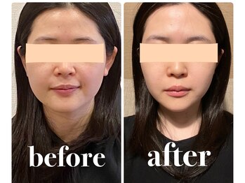 クリーム 京都店(Cream)/エラといえば、Cream!