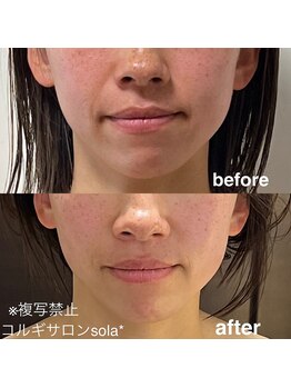 ソラ(sola*)/『迷う時間』より『変わる時間』