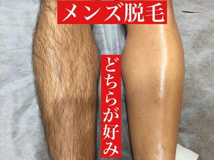 アン(an.)の写真