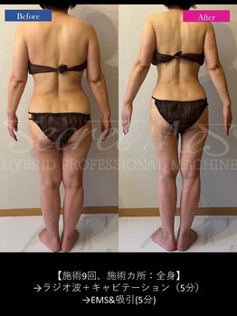 メルシー(Merci)/後ろ姿、意識されてますか？