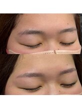 ブリス 姫路(Bliss)/お客様Before/After