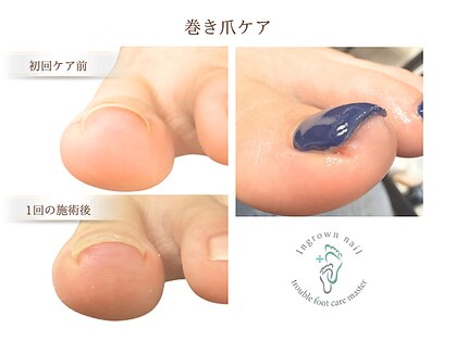リケアネイル(Re:care nail)の写真