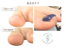 リケアネイル(Re:care nail)