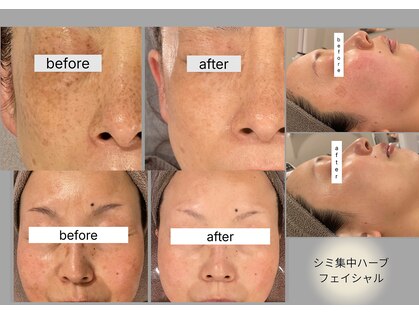 ブリノス(BLINOSS)の写真